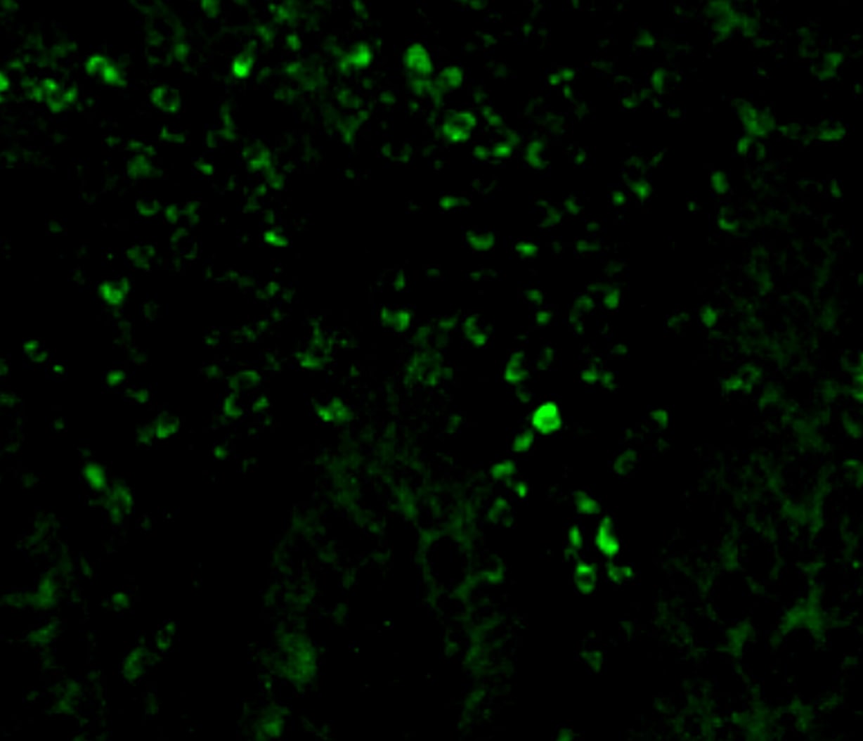 Human Serum Amyloid A1 Antibody MAB30191