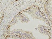 Human CNTFR alpha Antibody MAB303