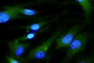 Mouse S100A8 Antibody MAB3059