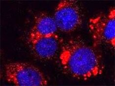Human WASP Antibody MAB3070