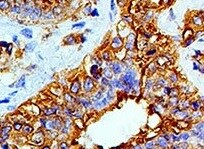 Human/Mouse FABP2/I‑FABP Antibody MAB30781