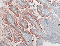 Human/Mouse FABP2/I‑FABP Antibody MAB30781