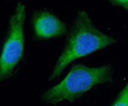 Human LINGO‑1 Antibody MAB30861