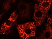 Rat Adiponectin/Acrp30 Antibody MAB3100