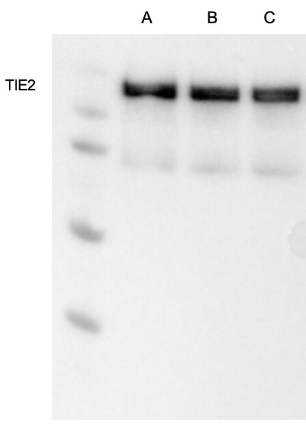 Human Tie‑2 Antibody MAB313