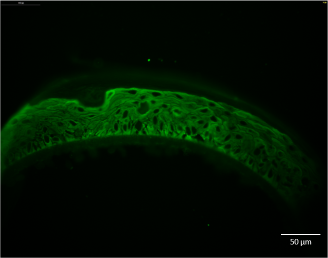 Human Cytokeratin 14 Antibody MAB3164