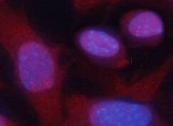 Human Cytokeratin 14 Antibody MAB3164