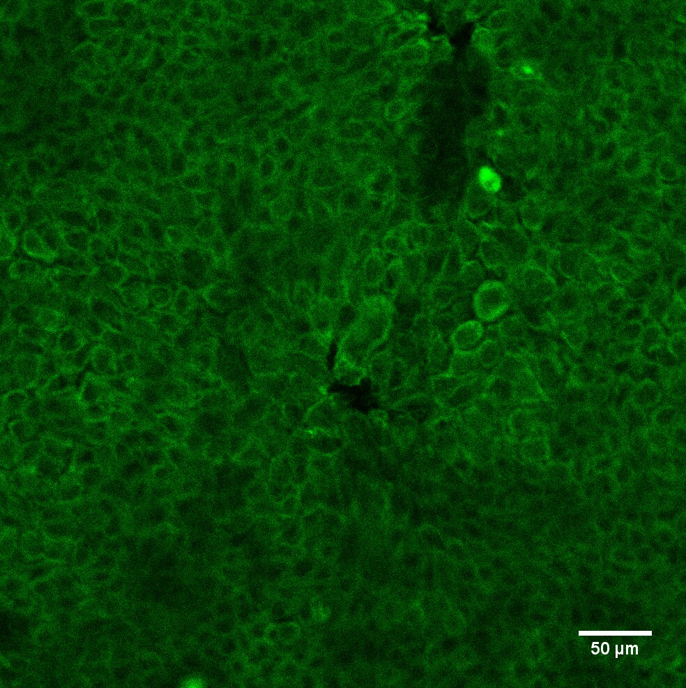 Human Cytokeratin 8 Antibody MAB3165