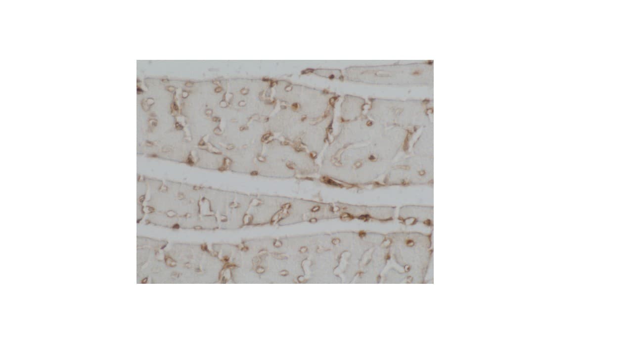 Human Myeloperoxidase/MPO Antibody MAB3174