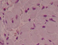 Human Myeloperoxidase/MPO Antibody MAB3174