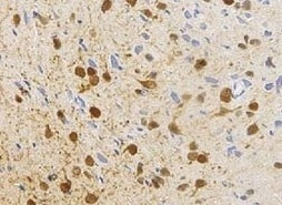 Human/Primate IL‑17/IL‑17A Antibody MAB317