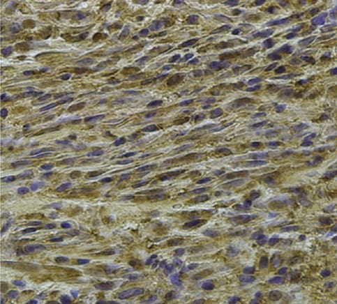 Human TRA‑1‑85/CD147 Antibody MAB3195