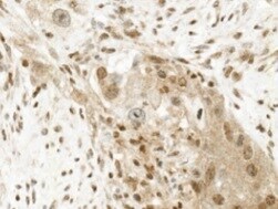 Human ERK3 Antibody MAB3196