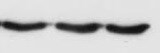 Human/Mouse/Rat Fgr Antibody MAB3207