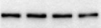 Human VEGFR1/Flt-1 Antibody MAB321