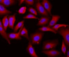 Human/Mouse/Rat eIF4E Antibody MAB3228