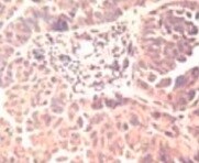 Human PDGF R alpha  Antibody MAB322