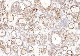 Human Mesothelin Antibody MAB32651