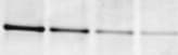 Human/Mouse/Rat PLC‑ gamma 1 Antibody MAB32881