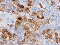 Human CCL16/HCC‑4 Antibody MAB328