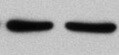 Human HSP10/EPF Antibody MAB3298