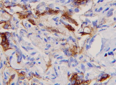 Mouse Coagulation Factor VII Antibody MAB33051