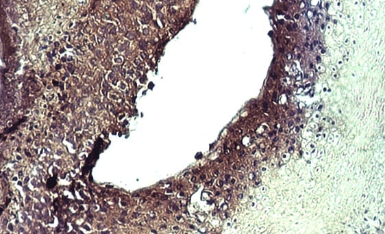 Human CXCR1/IL-8RA Antibody MAB330