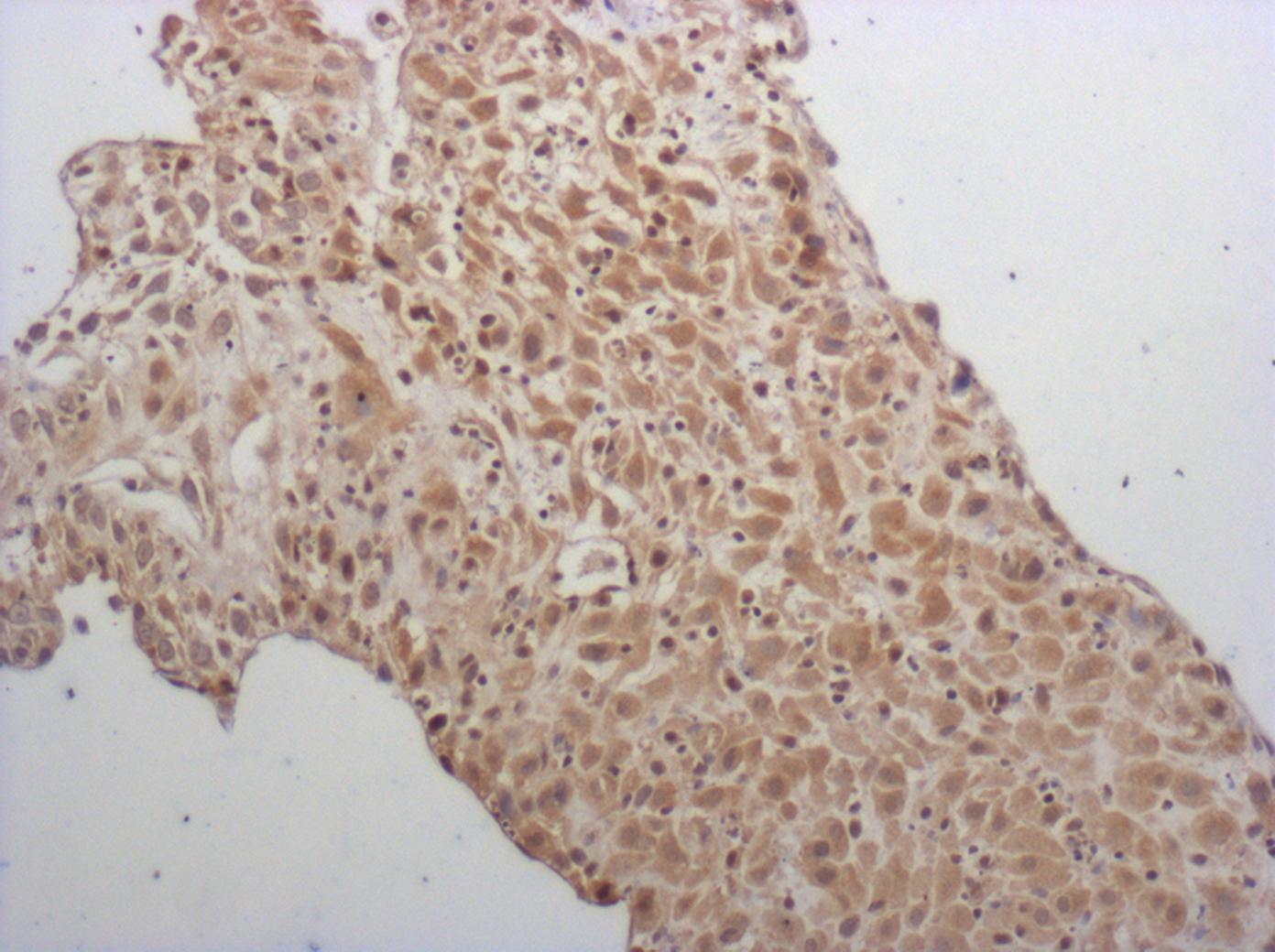 Human CXCR1/IL-8RA Antibody MAB330
