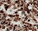 Human CXCR1/IL-8RA Antibody MAB330