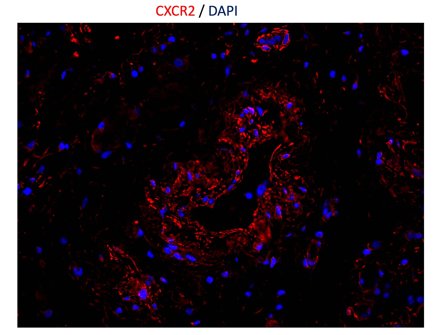 Human CXCR2/IL-8RB Antibody MAB331