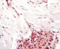 Human CXCR2/IL-8RB Antibody MAB331