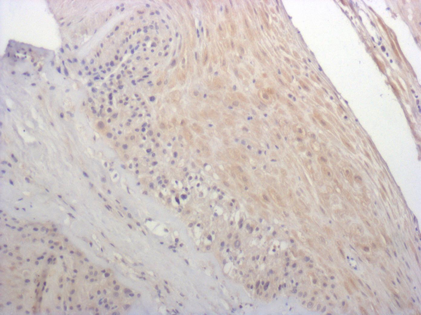 Human CXCR2/IL-8RB Antibody MAB331
