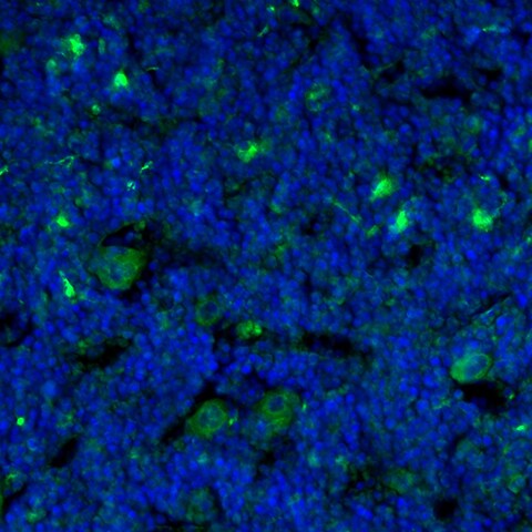 Mouse CD48/SLAMF2 Antibody MAB3327