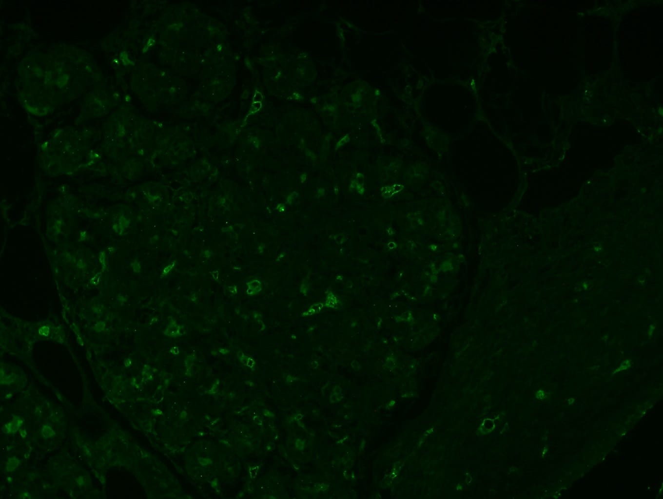 Human CCL25/TECK Antibody MAB3341