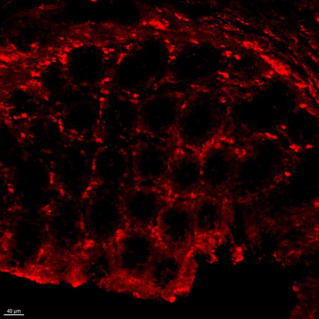 Human CCL25/TECK Antibody MAB3341