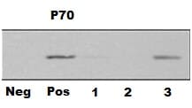 Human/Mouse/Rat SOD2/Mn‑SOD Antibody MAB3419