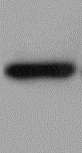 Human/Mouse/Rat SOD2/Mn‑SOD Antibody MAB3419