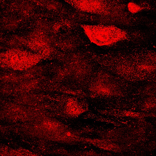 Human Myocilin Antibody MAB3446