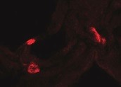 Human VEGFR3/Flt-4 Antibody MAB3491