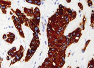 Human Cytokeratin 19 Antibody MAB35061