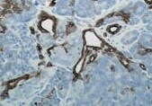 Human Cytokeratin 19 Antibody MAB3506
