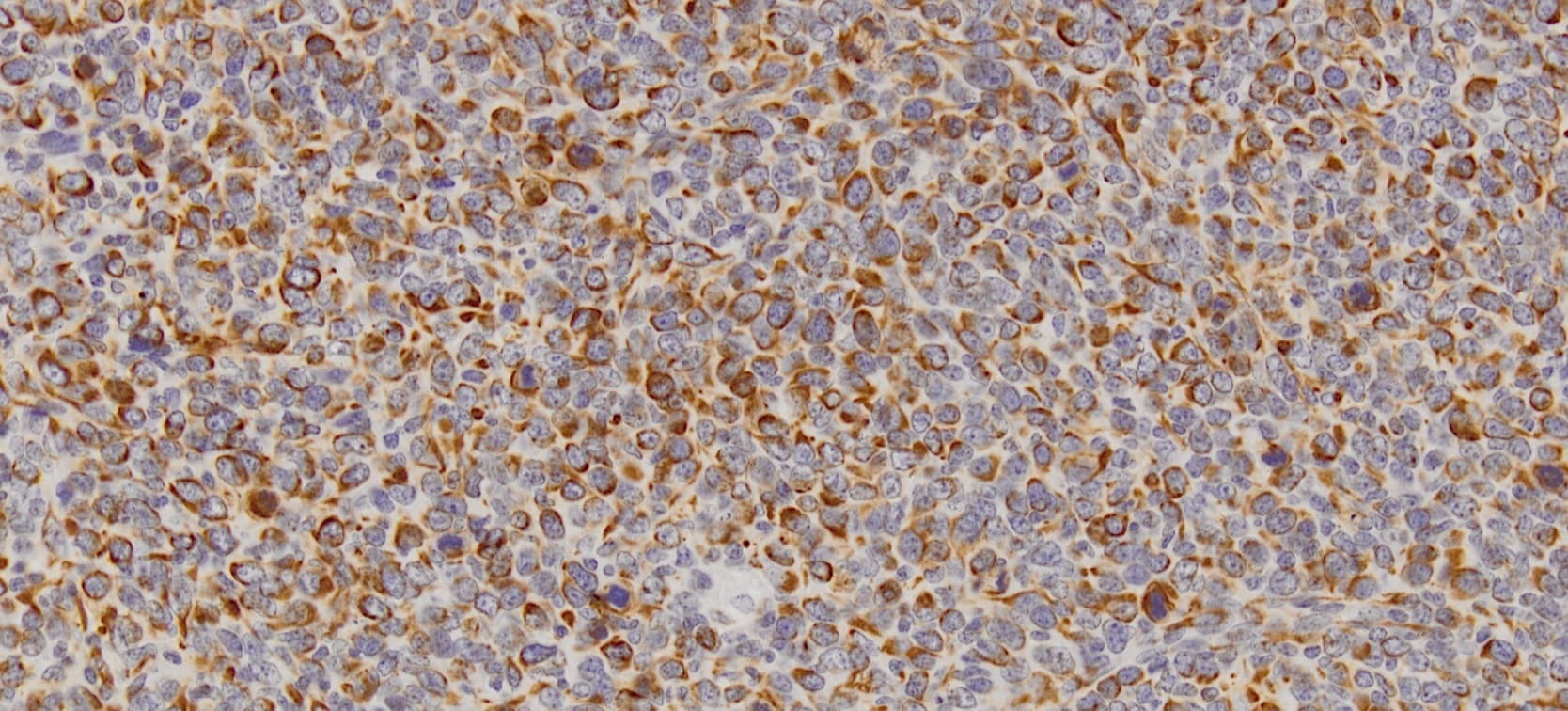 Human/Mouse CXCL12/SDF‑1 Antibody MAB350
