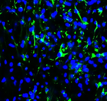 Human/Mouse CXCL12/SDF‑1 Antibody MAB350