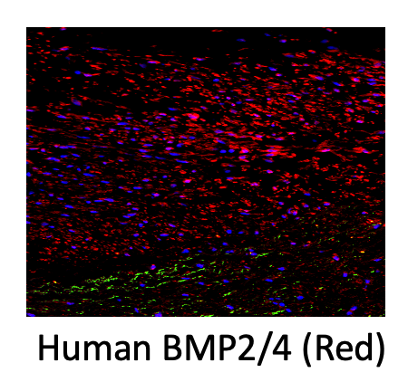 Human BMP‑2/BMP‑4 Antibody MAB3552