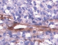 Human VEGFR2/KDR/Flk-1 Antibody MAB3571