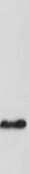 Human CCL20/MIP‑3 alpha  Antibody MAB360