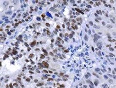 Human Pygopus‑2 Antibody MAB3616