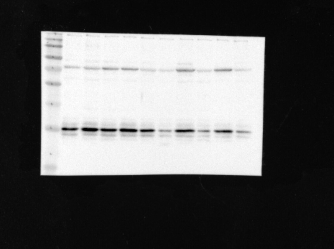 Human/Mouse Pygopus‑1 Antibody MAB3617