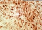 Mouse IL‑33 Antibody MAB3626