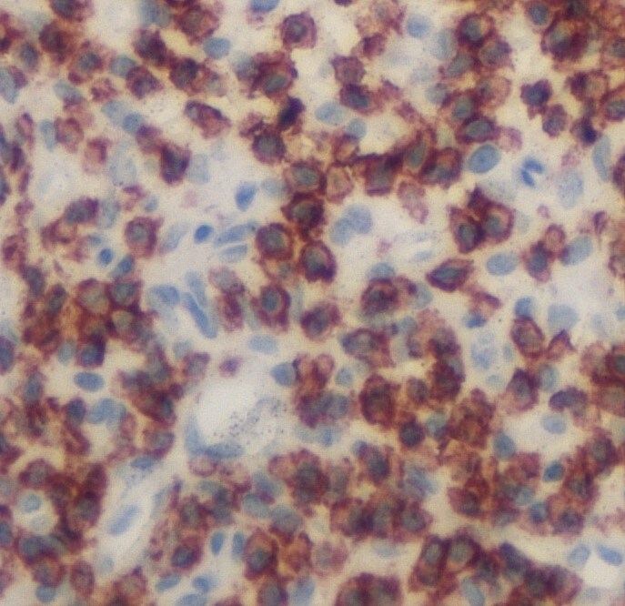 Human CD48/SLAMF2 Antibody MAB3644